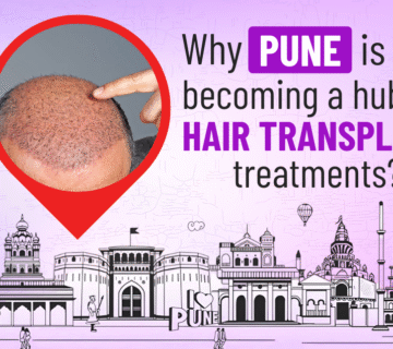 Hair transplant in Pune before and after results with FUE and DHI
