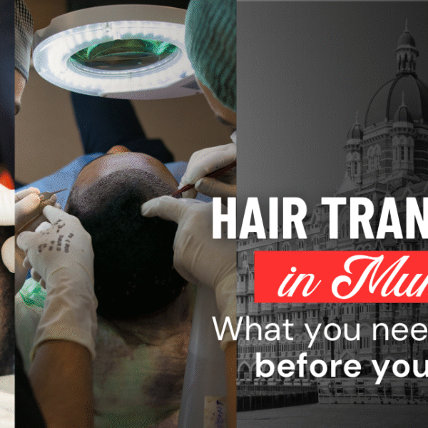 FUE hair transplant in Mumbai surgery procedure