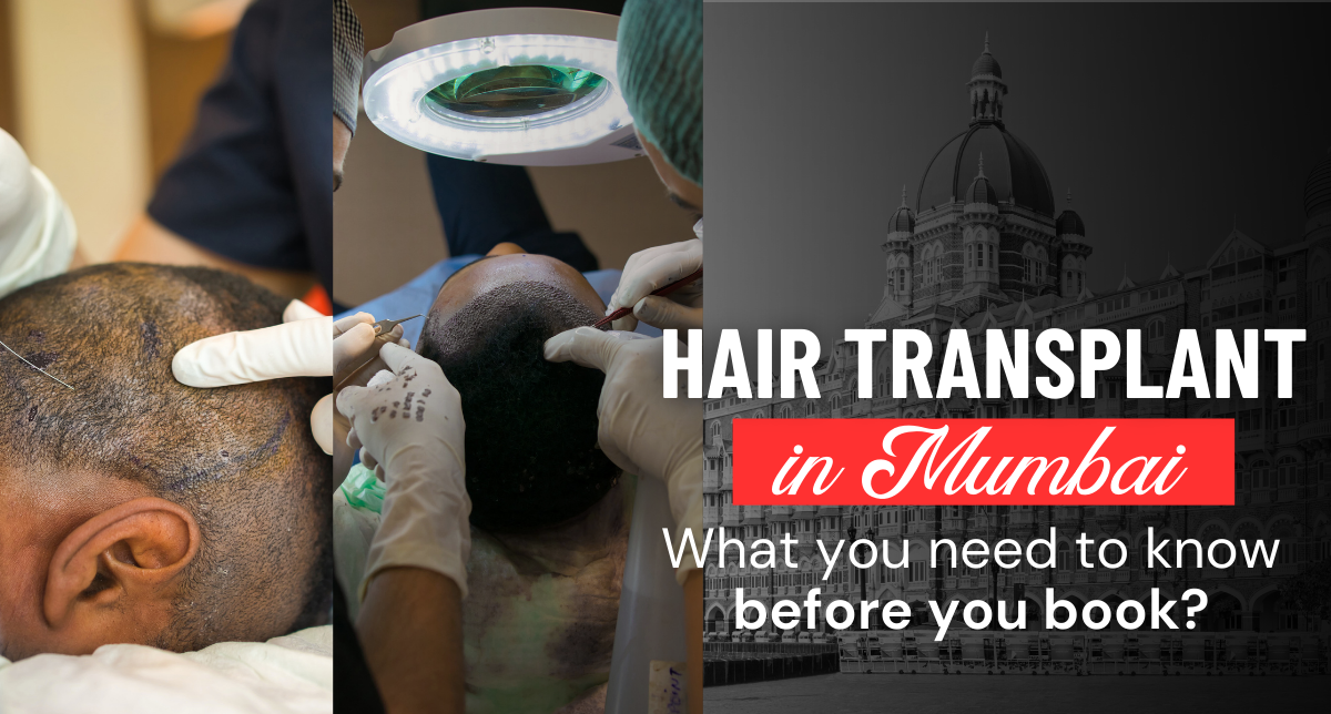 FUE hair transplant in Mumbai surgery procedure