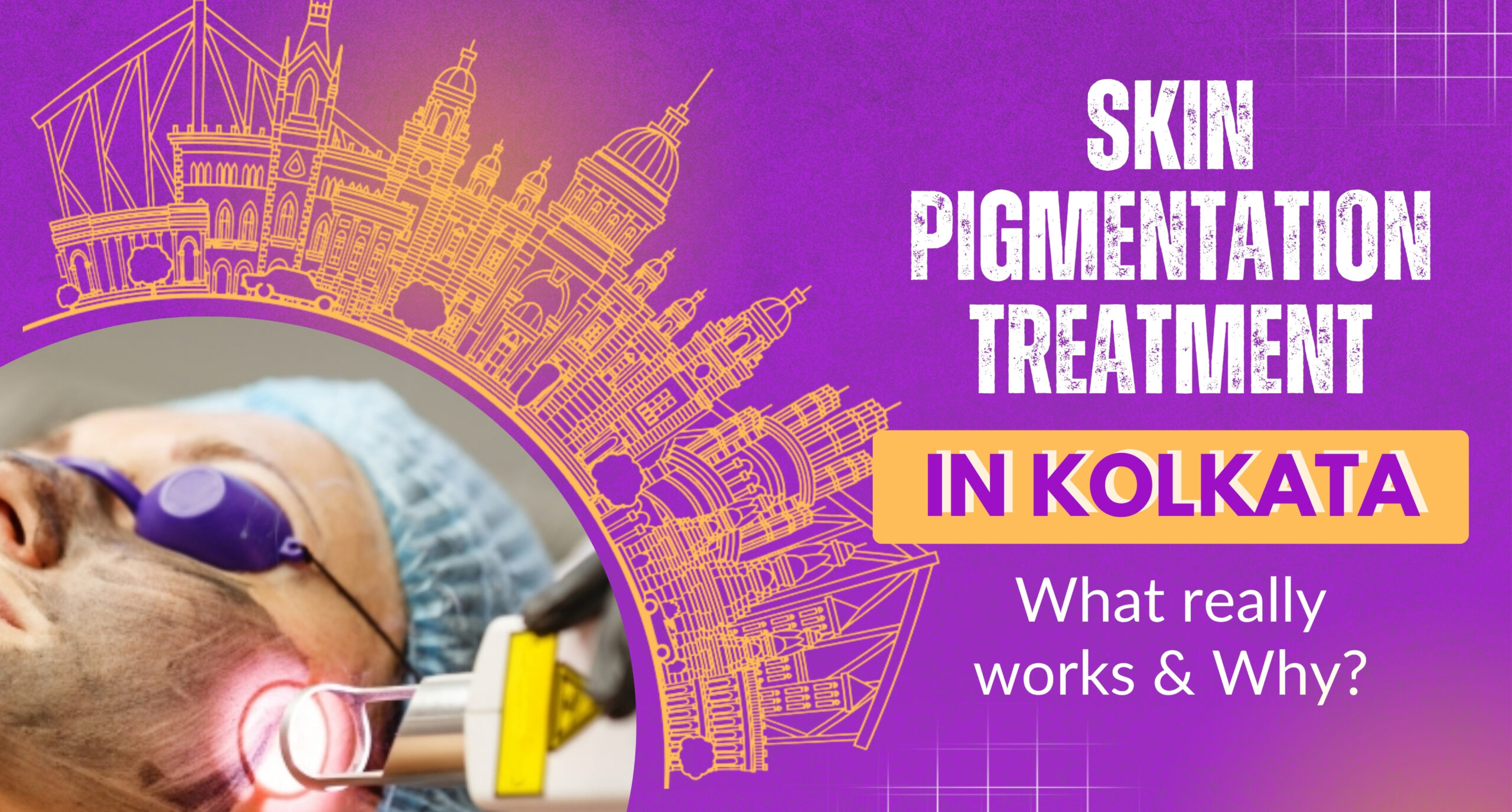 Skin Pigmentation Treatment in Kolkata: What Really Works