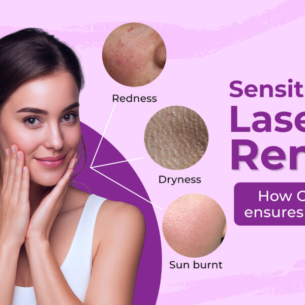 Sensitive skin and laser hair removal — safe, dermatologist-supervised treatment at CosmoLooks.