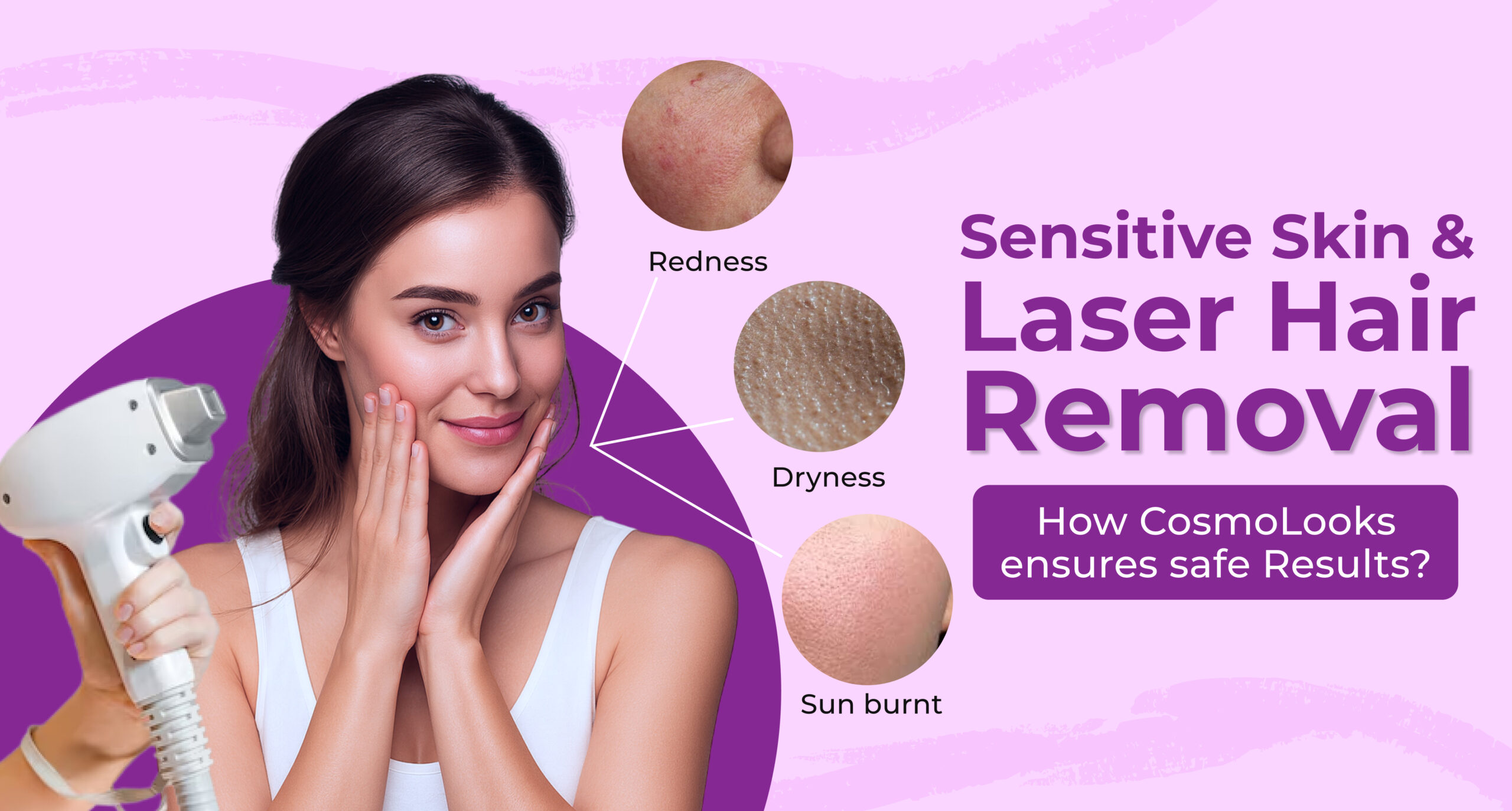 Sensitive skin and laser hair removal — safe, dermatologist-supervised treatment at CosmoLooks.