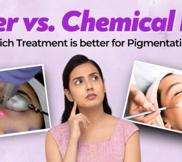 laser vs chemical peel for pigmentation treatment explained by dermatologist