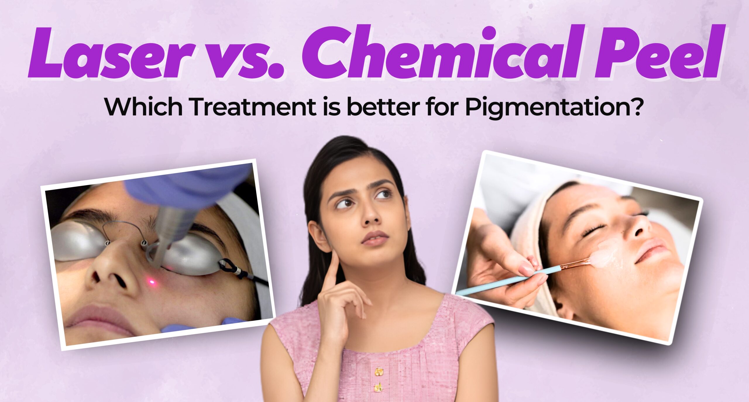 laser vs chemical peel for pigmentation treatment explained by dermatologist