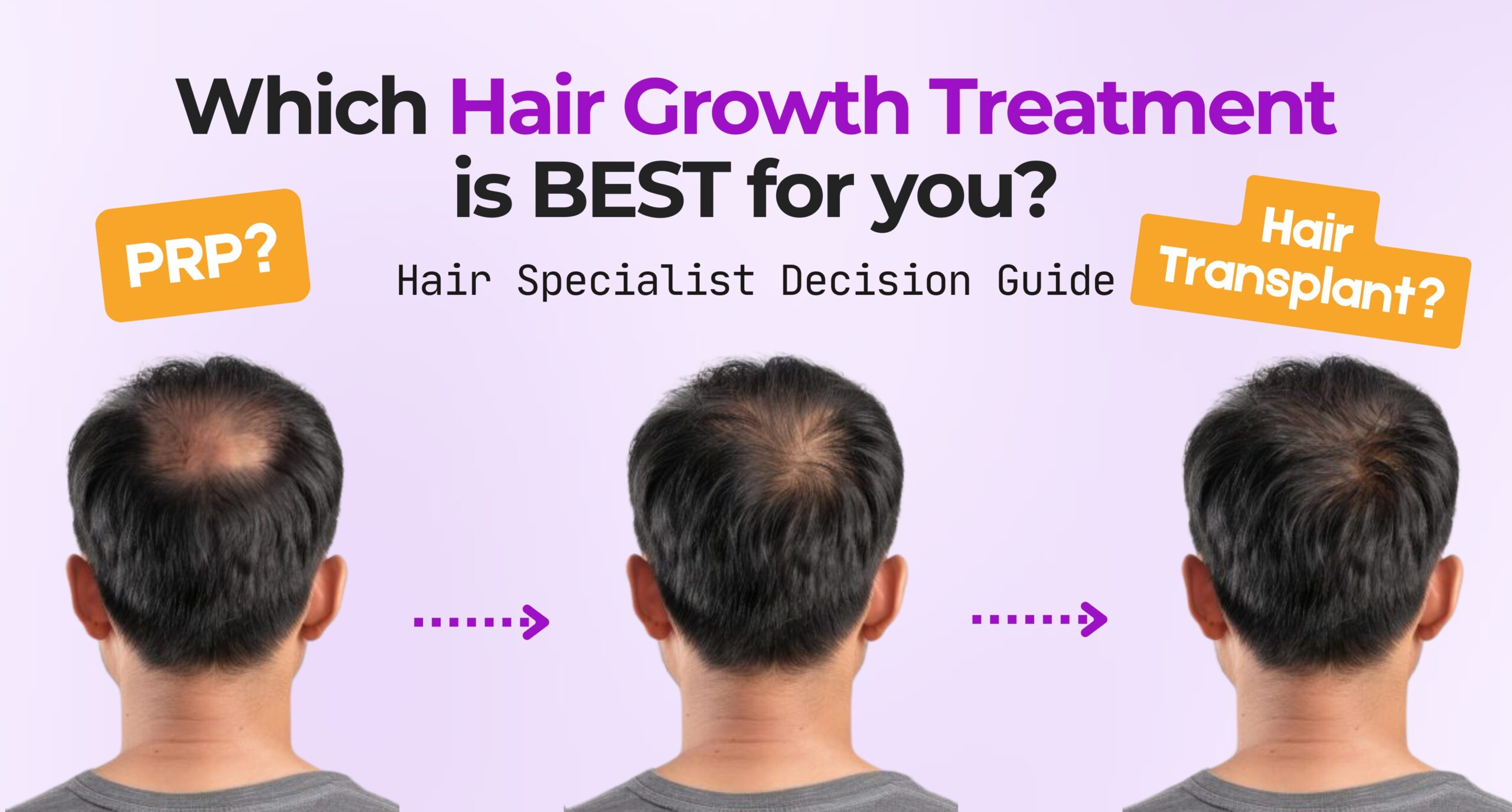 Which hair regrowth treatment is best for an individual at CosmoLooks.