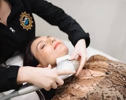 Neck & chin laser hair reduction